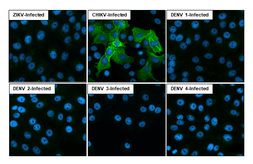 Anti-Chikungunya virus nsP1 antibody [HL2608] used in Immunocytochemistry/ Immunofluorescence (ICC/IF). GTX639060